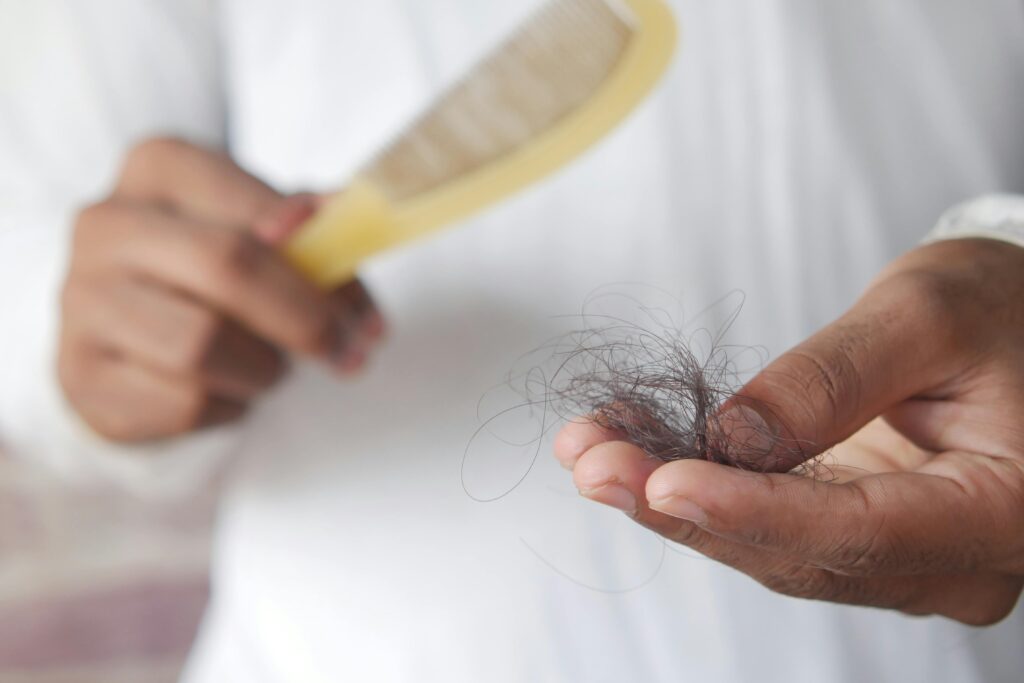 Queda de cabelo e ferritina