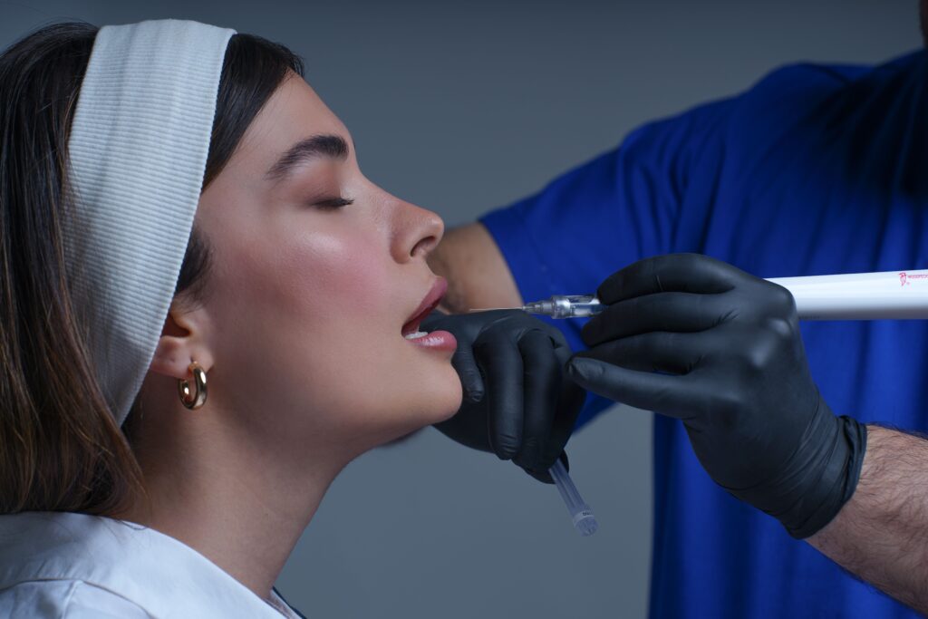 Botox depois dos 40