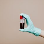 Tubos de exame de sangue para avaliação de triglicerídeos e colesterol